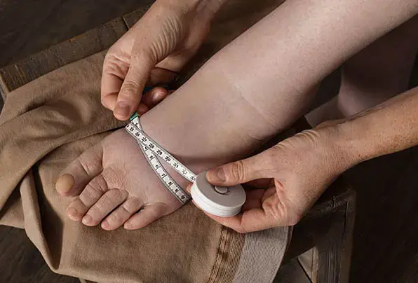 Lymphedema-serious