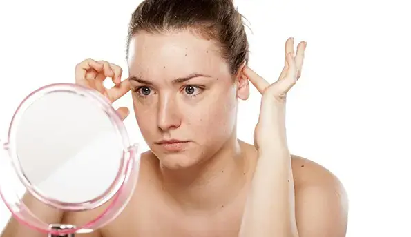 otoplasty-2